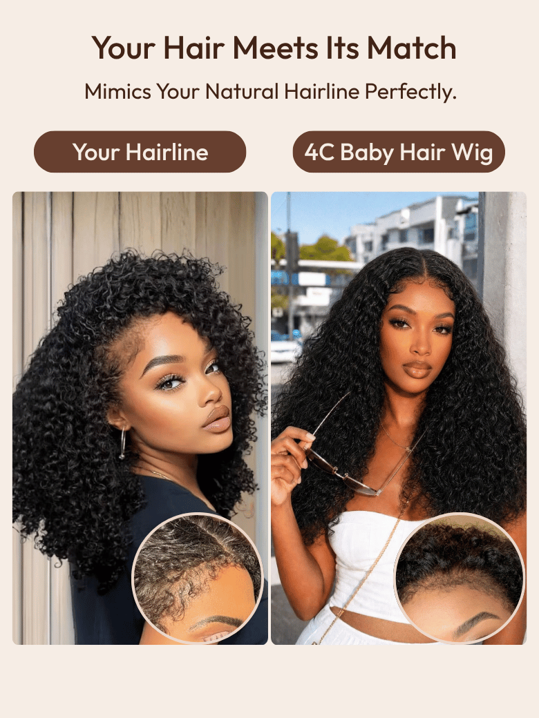 UNice Pre-Defined Layered Kinky Curly Wig Bye-Bye Slip™ 7×5 Lace Closure Glueless Blend-Ready Voluminous Natural Curls