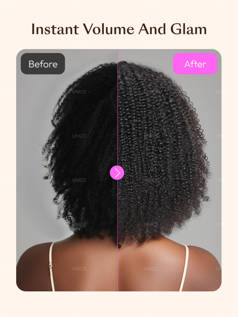 A model displays the UNice Invisi Blend UNice Coily Curly Glueless Flip Over Kinky Curly Wig for Beginner, showing a model with a hair transplant before and after.